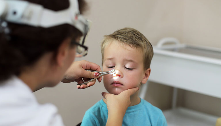 Excision of nasal polyps in children