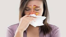 Nose and sinus cancer