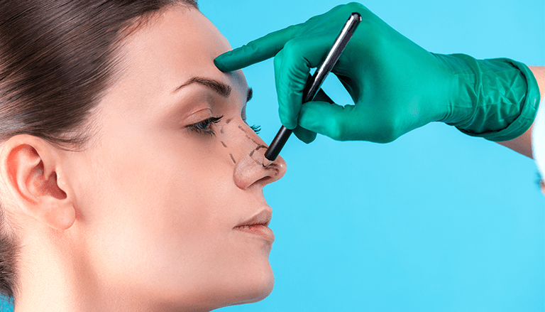 Nasal Surgery and Rhinoplasty - Dr. Anas Abu Shamhla - Otolaryngologist - Book your appointment now.